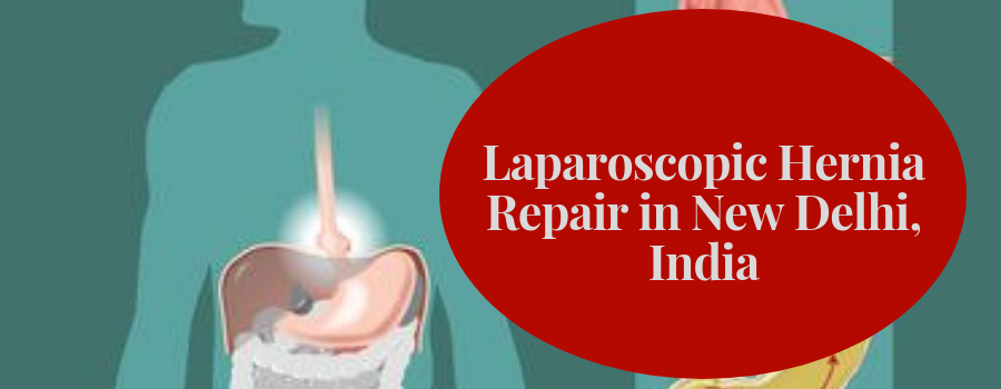 Laparoscopic Hernia Repair in New Delhi, India